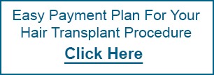 Hair Transplant Payment Plan